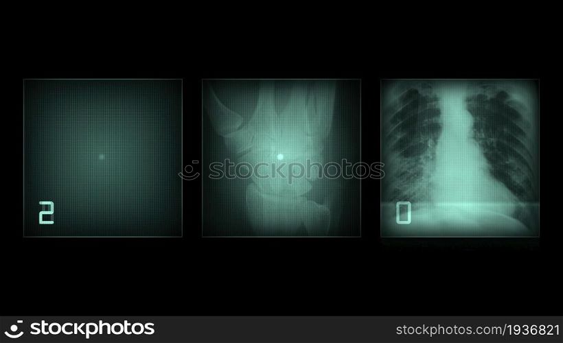 3d illustration - x-ray panels on black background