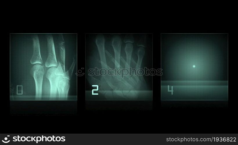 3d illustration - x-ray panels on black background