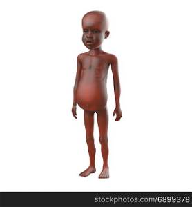 3d render of an African child suffering malnutrition