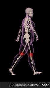 3D render of an overweight female medical skeleton walking with knee joints highlighted