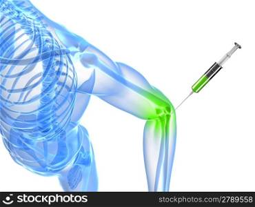 3d rendered illustration showing an elbow joint injection