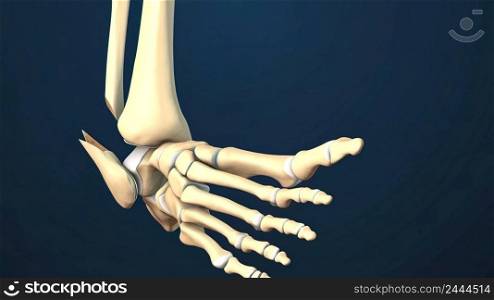 3D rendering showing fracture talus bone.