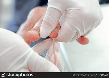 A blood test is a laboratory analysis performed on a blood sample that is usually extracted from a vein in the arm using a hypodermic needle, or via fingerprick. Modern hospital hematology laboratory.