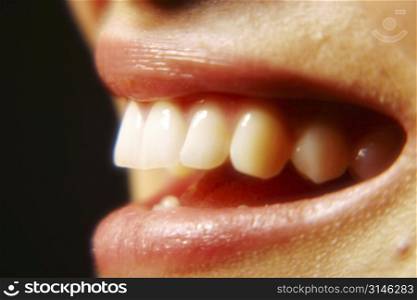 a close up image of a womans mouth showing her white teeth.