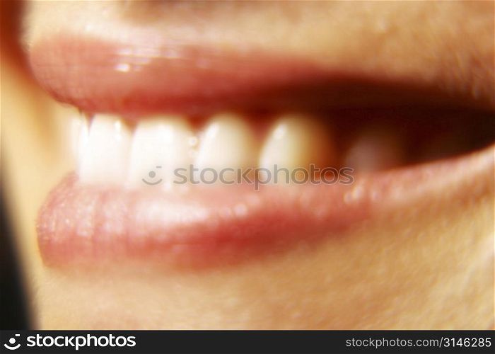 a close up image of a womans mouth showing her white teeth.
