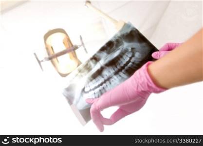 A dentist&rsquo;s hand holding up an x-ray for the patient