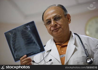 A doctor examining the X-Ray sheet