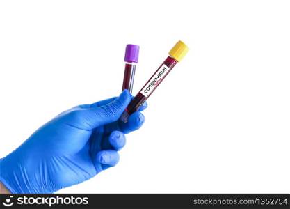 A gloved hand holding a positive blood test result for coronavirus