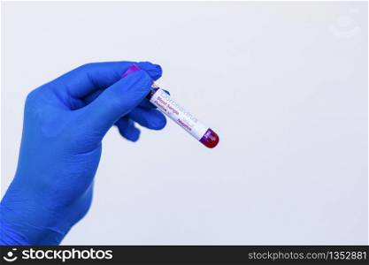 A gloved junior doctor holding a positive blood test result for coronavirus