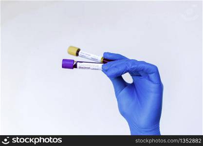 A gloved junior doctor holding a positive blood test result for coronavirus