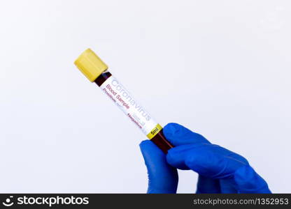 A gloved junior doctor holding a positive blood test result for coronavirus