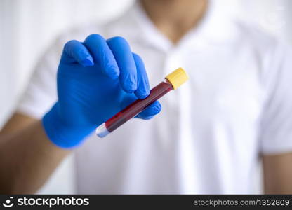 A gloved junior doctor holding blood test result for plasma in Turkey