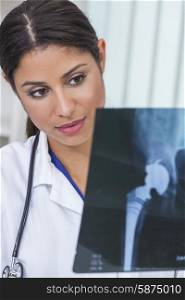 A Latina Hispanic female medical doctor surgeon looking at hip replacement x-ray in a hospital