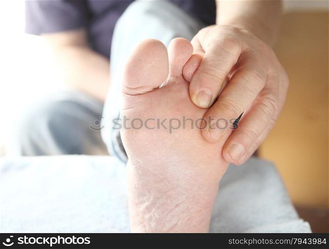 A man checks the skin condition on his foot.