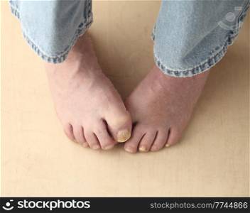 A man is embarrassed at his foot problems.