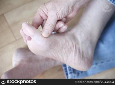 A man scratches the fungal infection between his toes.