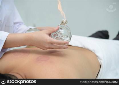 A person receiving cupping treatment on back in spa,traditional chinese medicine treatment.