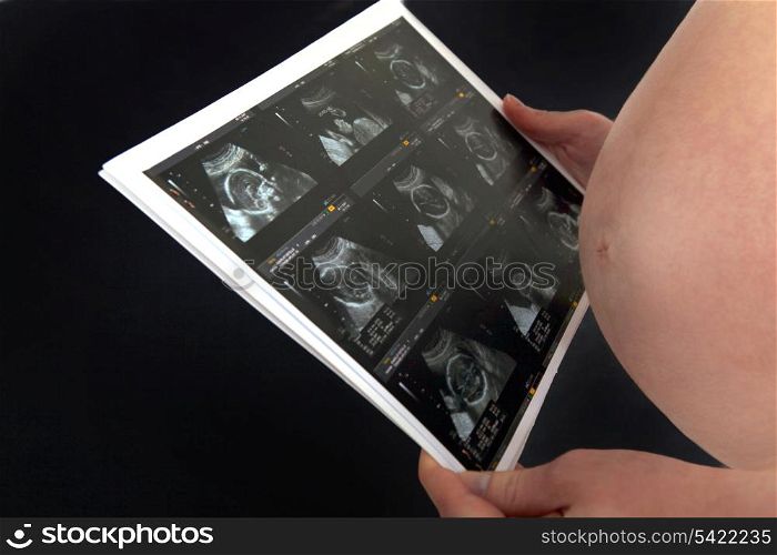 A pregnant woman looking at her echography.