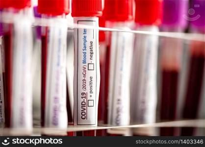 A row of human blood samples in a medical laboratory ready to be tested. healthcare background