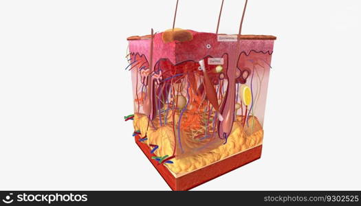 A second degree burn will affect the epidermis and part of the dermis of the skin. 3D rendering. A second degree burn will affect the epidermis and part of the dermis of the skin.