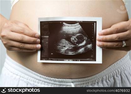 A shot of a pregnant woman carrying her child&acute;s ultrasound picture