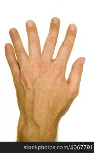 A stock photograph of a man&acute;s hand with six fingers.
