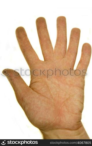 A stock photograph of a man&acute;s palm with six fingers.