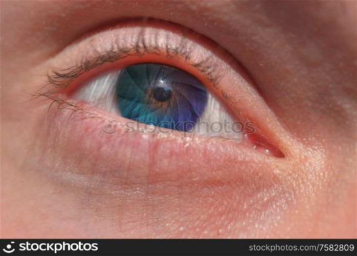 Abstract Aperture of the eye