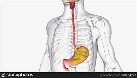 Acid reflux is caused by the involuntary release of stomach acid into the esophagus, throat, and mouth. 3D rendering. Acid reflux is caused by the involuntary release of stomach acid into the esophagus, throat, and mouth.