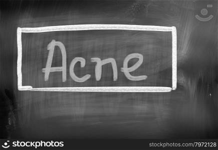 Acne Concept