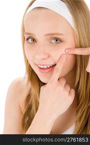 Acne facial care teenager woman squeezing pimple on white