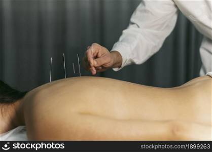 acupuncture process. Resolution and high quality beautiful photo. acupuncture process. High quality beautiful photo concept