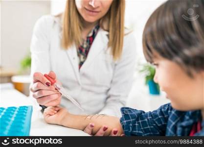 Allergy - Skin Prick Tests on Little Boy’s Arm. Allergy - Skin Prick Testing