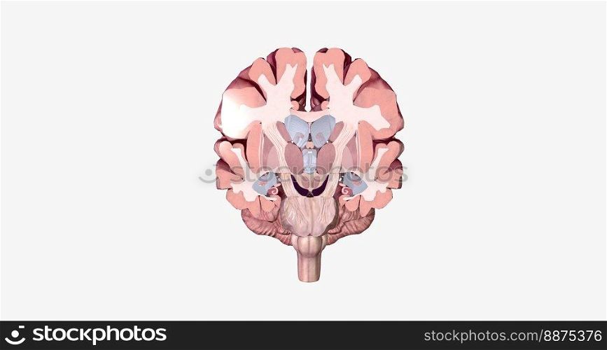 Alzheimer’s Disease Brain Cross Section 3D rendering. Alzheimer’s Disease Brain Cross Section