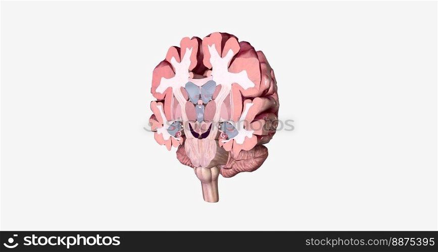 Alzheimer’s Disease Brain Cross Section 3D rendering. Alzheimer’s Disease Brain Cross Section