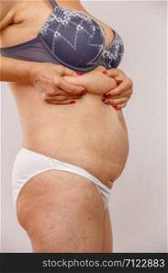 An elderly woman in white panties shows the folds on her abdomen on a white isolated background.