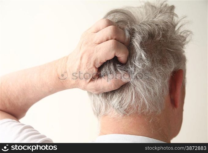 An older man has an irritated scalp.