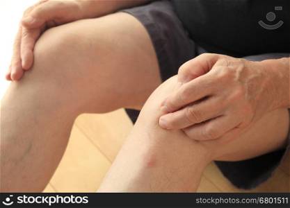 An older man sits on the floor with his hands on his painful knees.