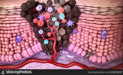 Antibodies destroy an infected cell by a virus, immun defense kill the infected cell 3D illustration. Antibodies destroy an infected cell by a virus, immun defense kill the infected cell