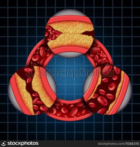 Artery disease symptoms diagram coronary medical concept as a circular vein with gradual plaque formation resulting in clogged arteries and atherosclerosis with with a three dimensional human anatomy diagram showing the risks of cholesterol buildup.