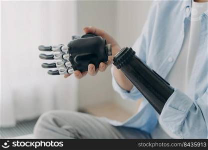 Artificial hand and arm with wrist joint. Disabled woman is disassembling prosthesis hand and arm. Bionic hand has processor chip, prosthetic sensor and buttons. High technology prosthesis.. Artificial hand and arm with wrist joint. Disabled woman disassembling high technology prosthesis.