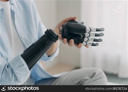 Artificial hand and arm with wrist joint. Disabled woman is disassembling prosthesis hand and arm. Bionic hand has processor chip, prosthetic sensor and buttons. High technology prosthesis.. Artificial hand and arm with wrist joint. Disabled woman disassembling high technology prosthesis.