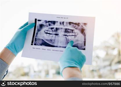 Asian male dentists are analyzing x-ray images of patients and pointing problem at the lab.