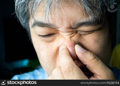 Asian people are squeezing the pimples and blackheads and acne scars on his nose.