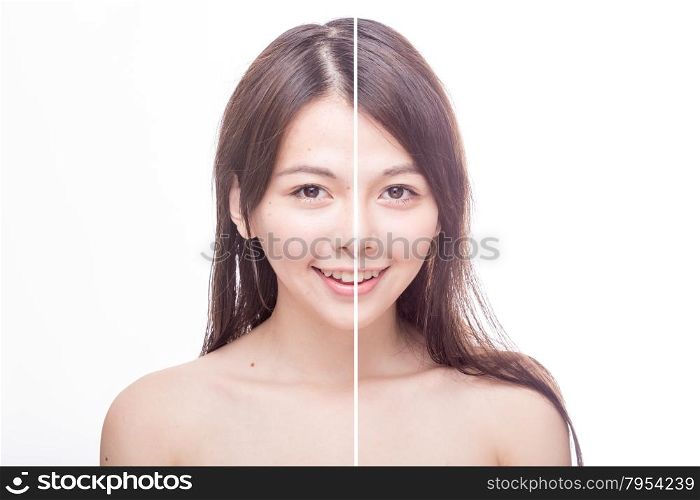 Asian woman&rsquo;s face, beauty concept, before and after