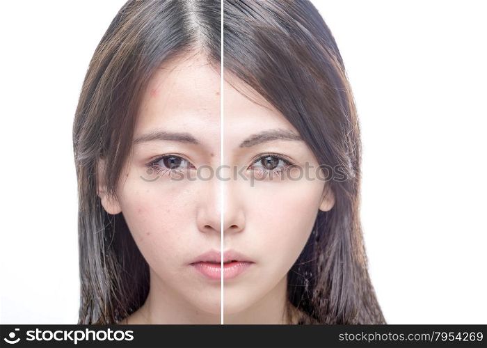 Asian woman&rsquo;s face, beauty concept, before and after