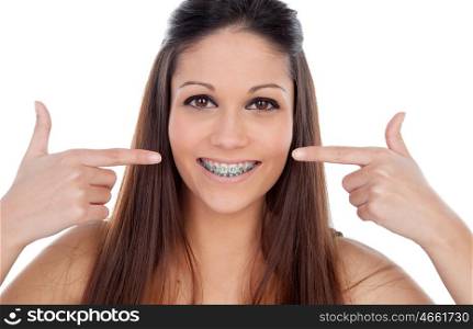 Attractive young woman pointing her brackets isolated on a white backgroung
