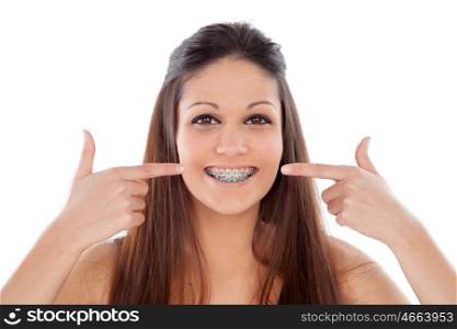 Attractive young woman pointing her brackets isolated on a white backgroung