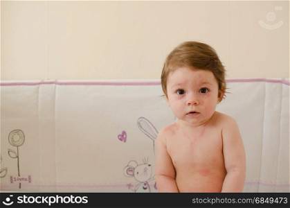baby girl body covered with roseola skin rash Sixth disease