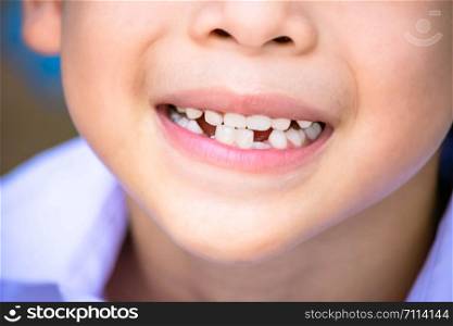 Baby teeth are just dropped in the mouth and regenerate tooth.